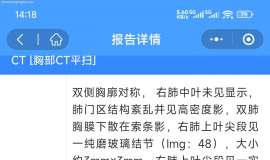 已经化疗4次，是否继续
